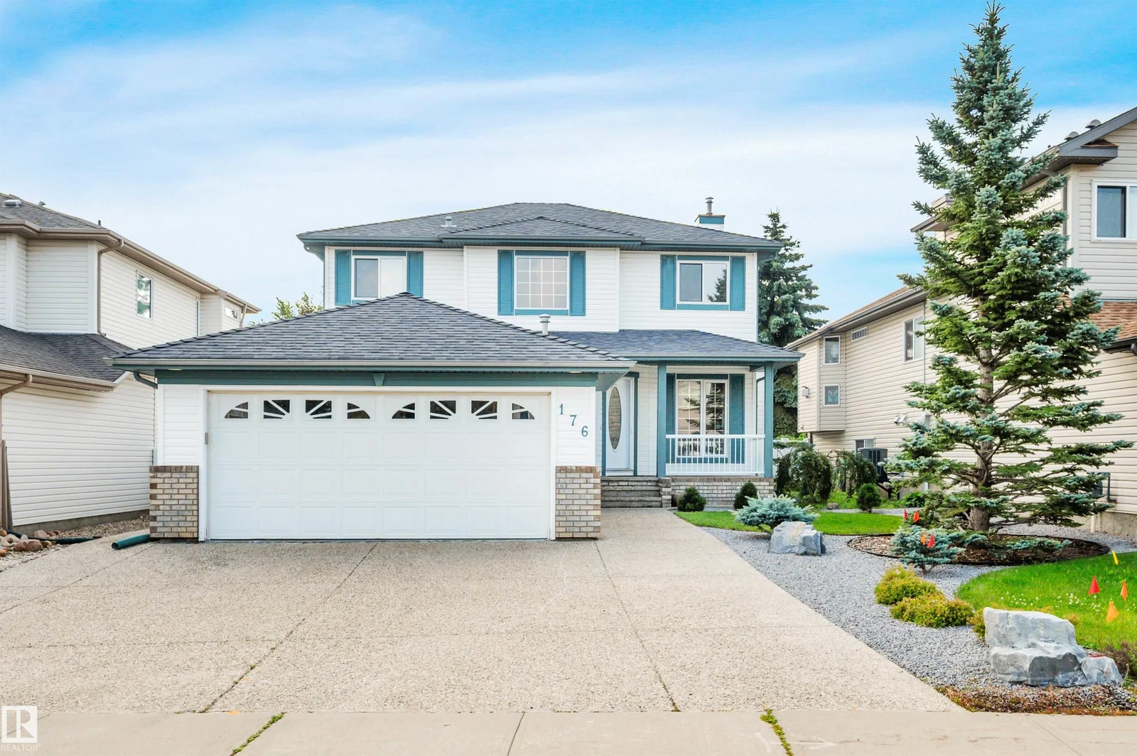 176 FORREST DR, Sherwood Park - 4 bedroom Detached Single Family for sale