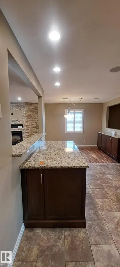 Photo 4 of 6307 92A AV NW