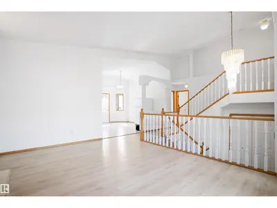 Photo 3 of 2915 151A AV NW
